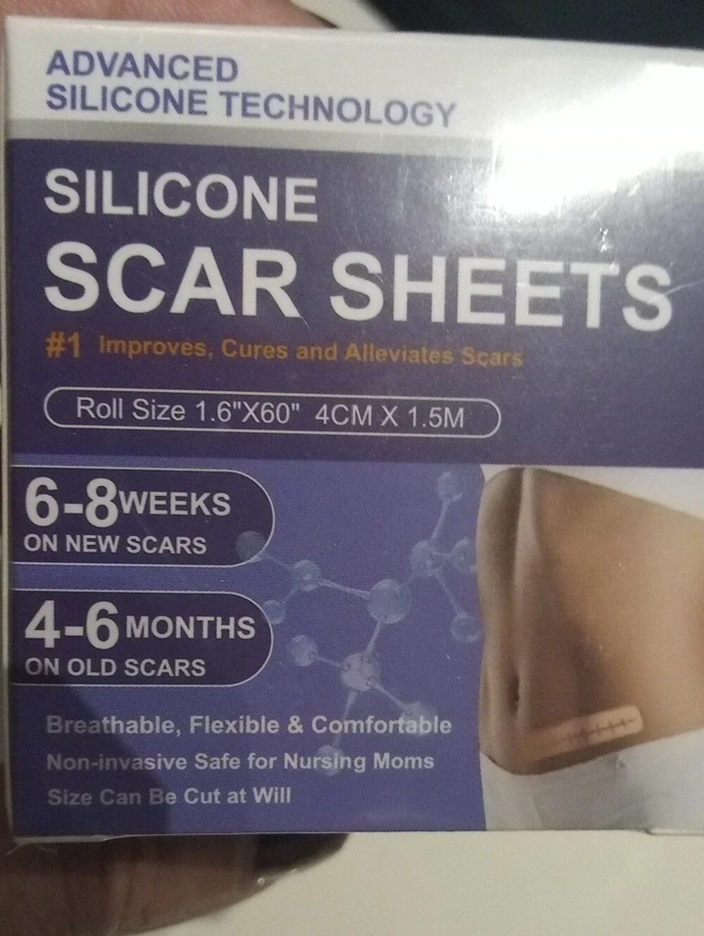 Silicone Scar Sheets, Advanced Medical Silicone Scar Tape(1.6